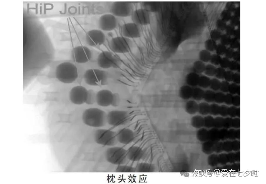 半导体制程中“球栅阵列封装（BGA）”焊点质量检测失效分析的详解； - 知乎