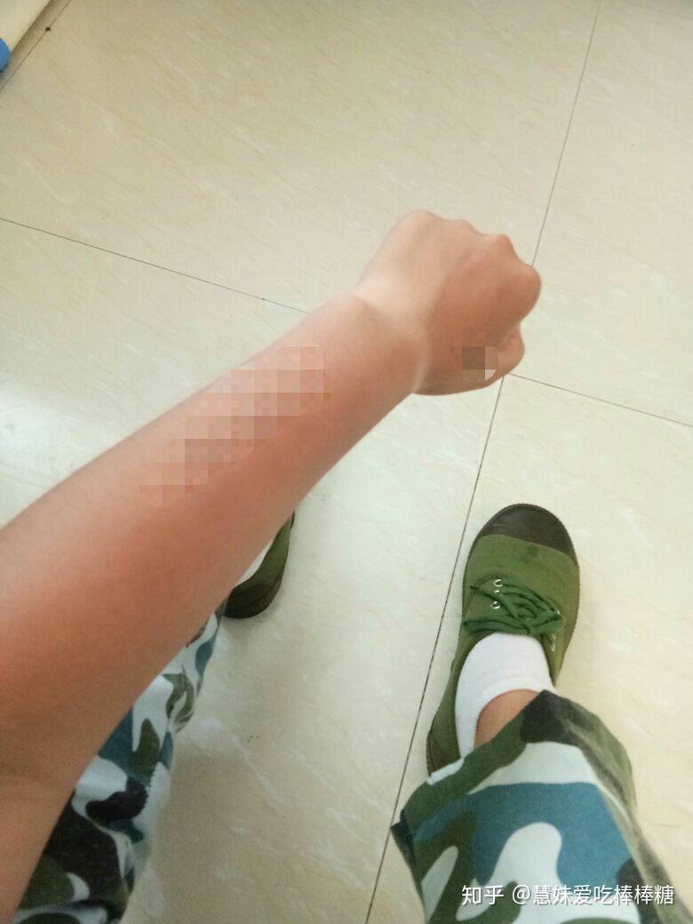 我军训晒黑辽,虽然之前不白,但是还是晒出了"分界线"慧妹爱吃棒棒糖