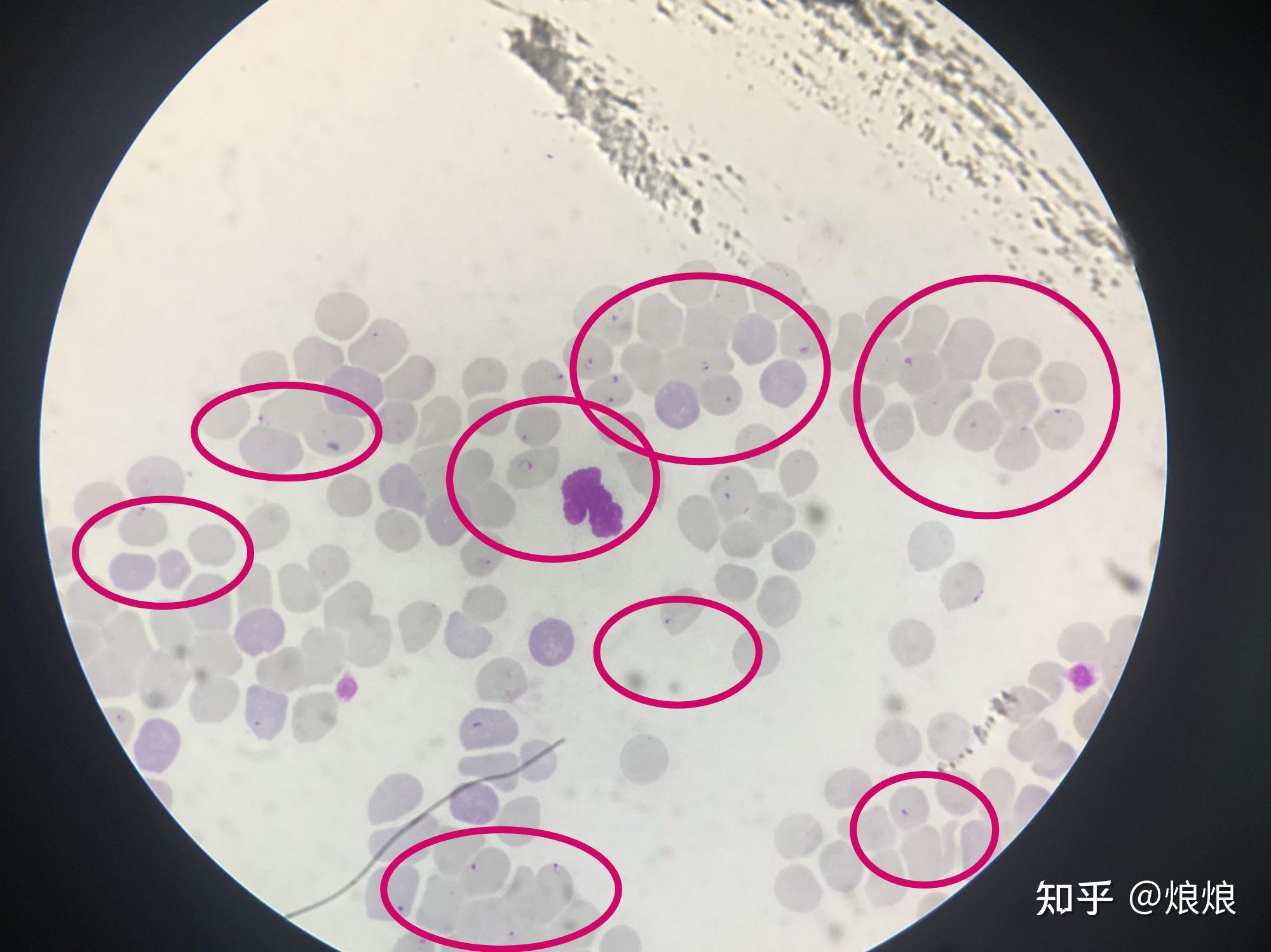 犬巴贝斯虫镜检图片图片