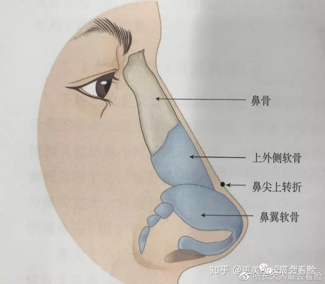 鼻整形的选择与权衡，认真看能帮你避免二次修复手术 - 知乎