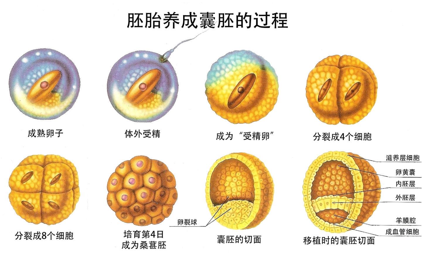 v2-56d38f10a3a5a63cfc77e3a82f4a8c8f_1440w.jpg?source=172ae18b