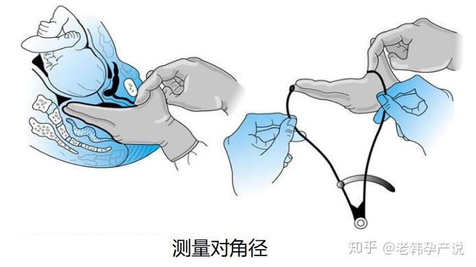 老韩孕产说史上最全的产检攻略孕妈必备