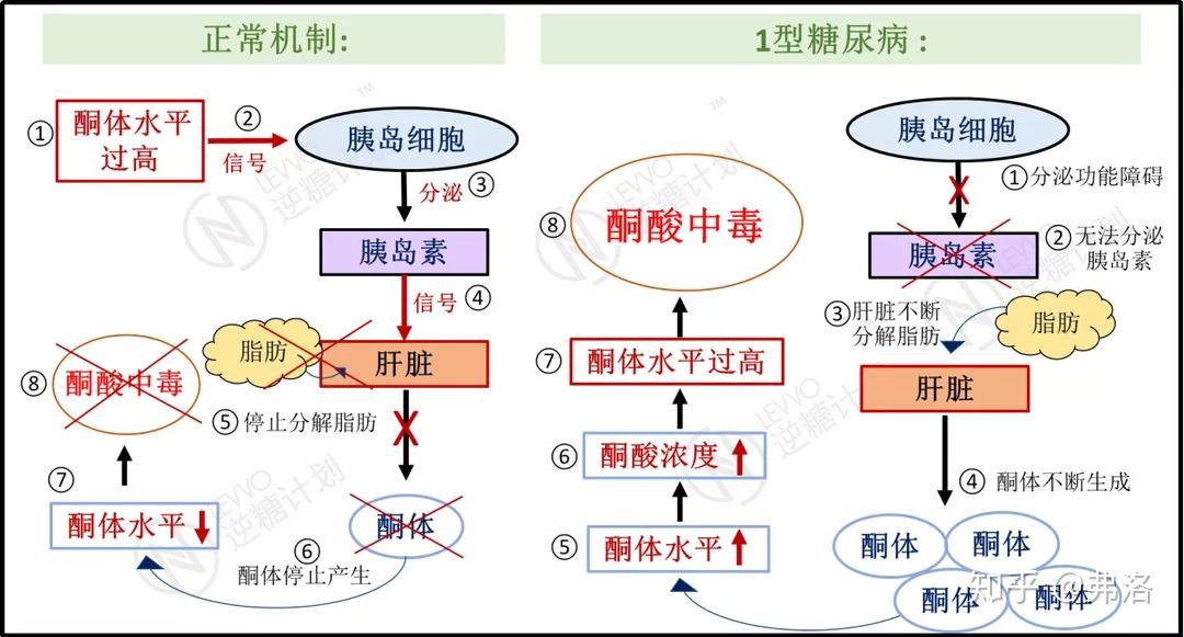 别再分不清营养性生酮和酮症酸中毒了! - 知乎