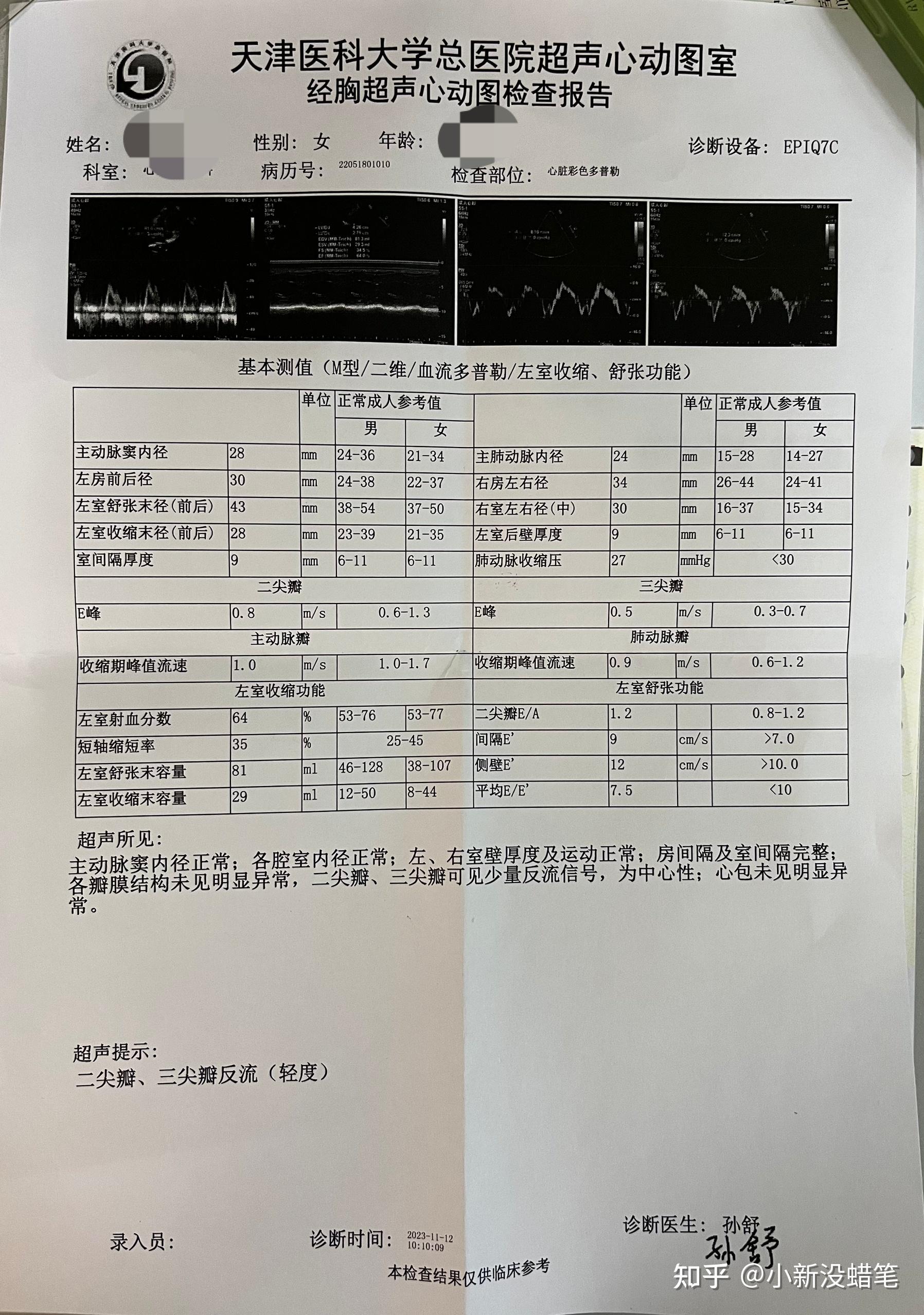 第一次做动态心电图