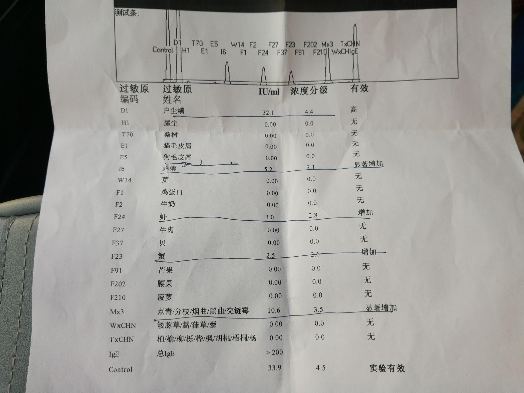 过敏性体质如何寻找到自己的过敏源医院可以检查出来吗