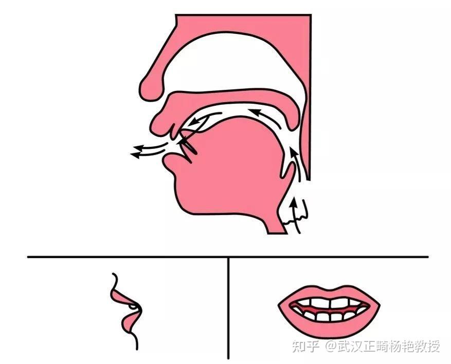 武汉牙齿矫正:牙齿高低还能影响发音,你注意到了没? - 知乎