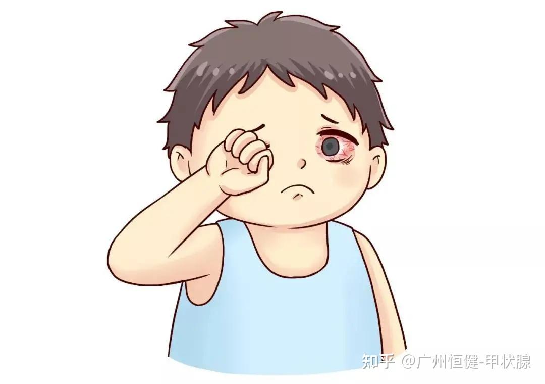 甲亢伴随突眼如何治疗预后效果怎么样