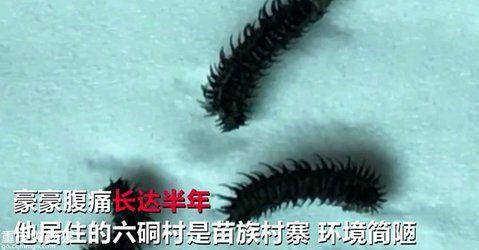 如何解释八岁幼童吐毛虫事件 知乎 如何解释八岁幼童吐毛虫事件 知乎