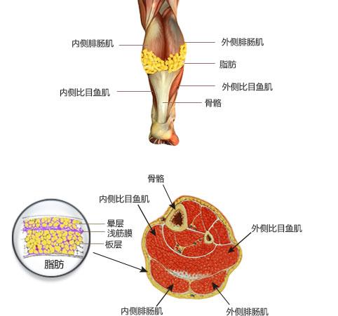 小腿内侧肌肉怎么减下去