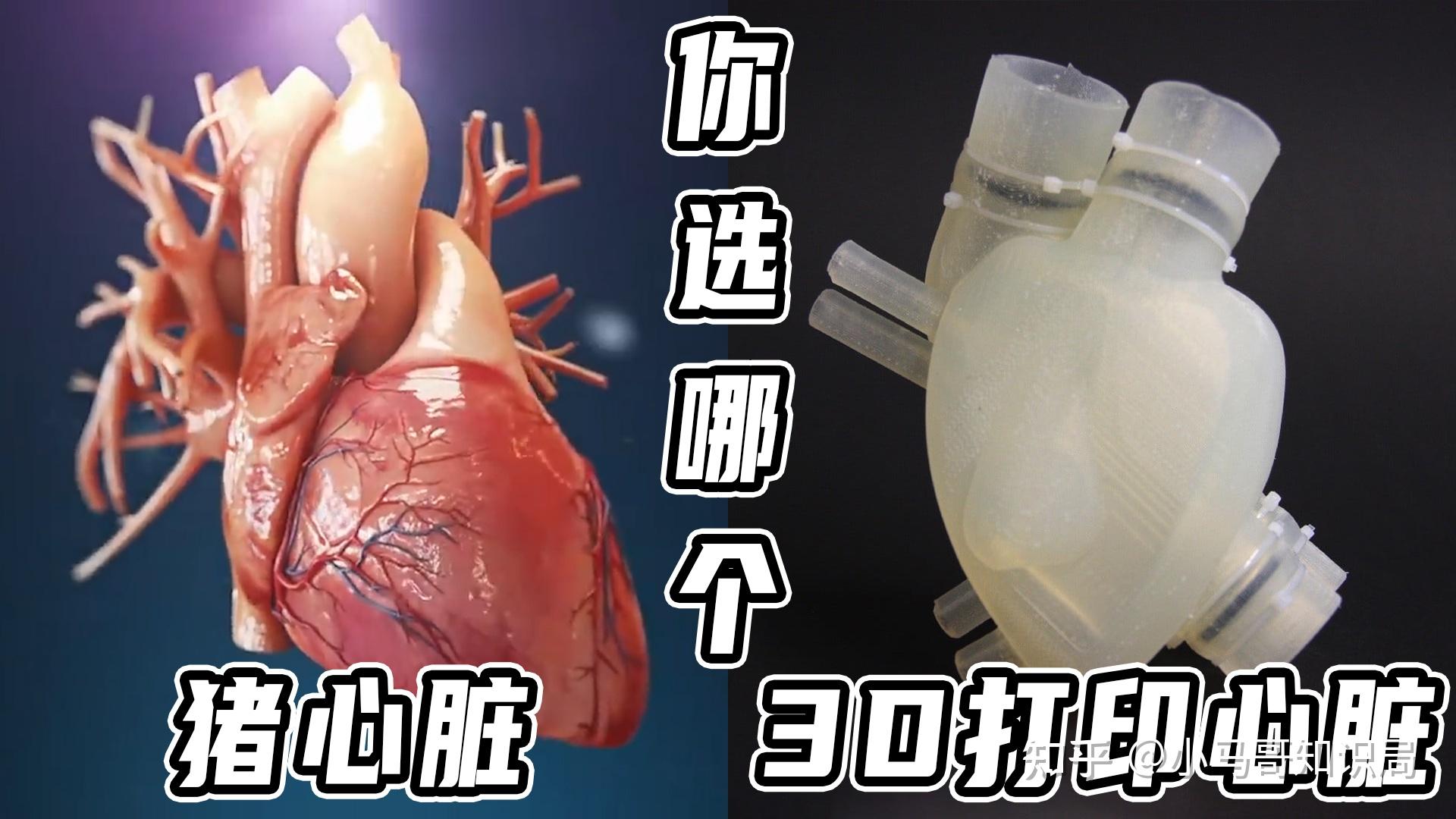 新知丨全球首例猪心脏移植人体手术完成——基因编辑后的心脏，能否给生命带来新曙光？_新华报业网