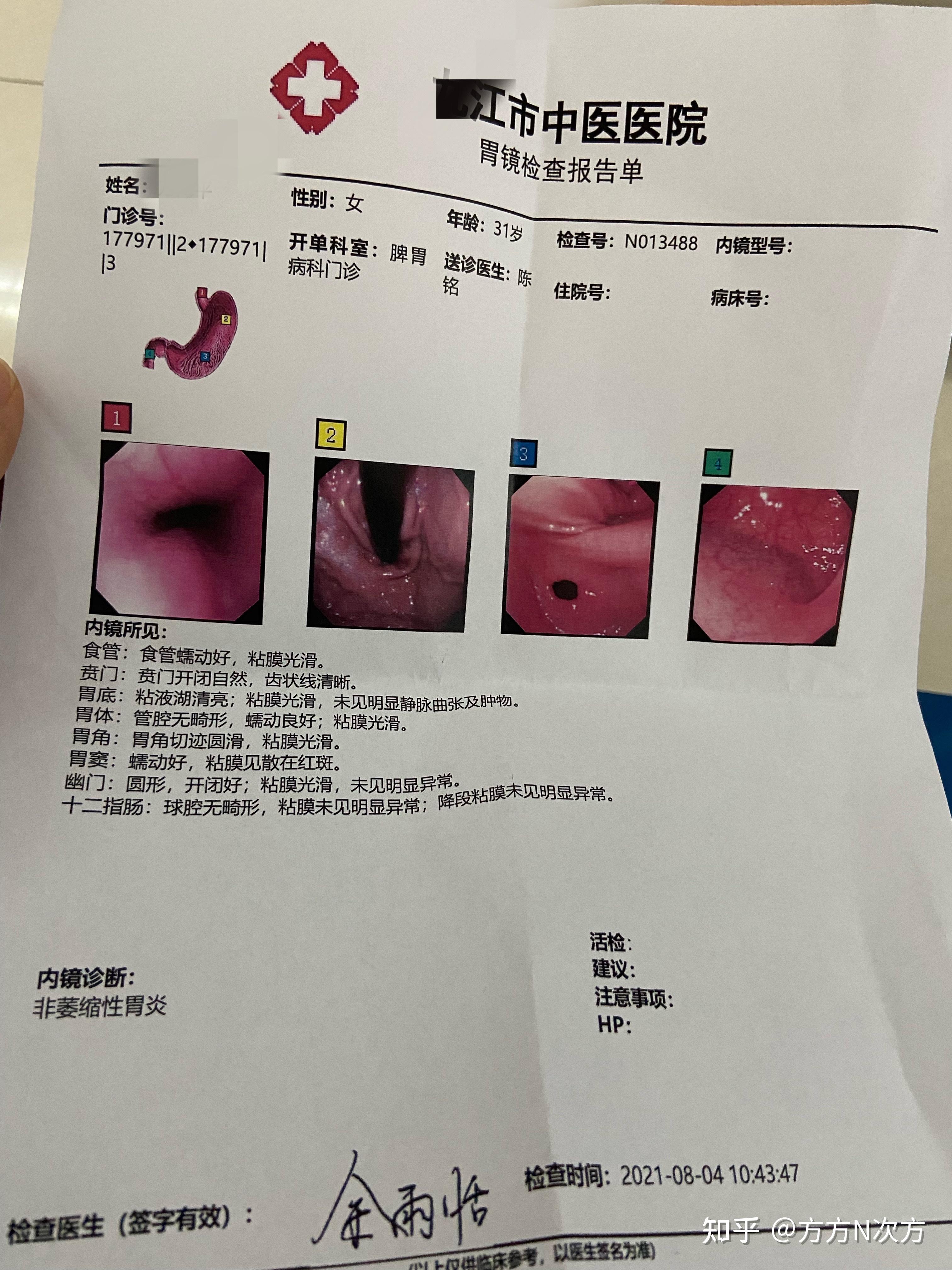 非萎缩性胃炎 局部中度肠化别担心