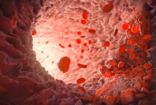 血管最喜欢的食物和稀释血液粘稠的方法