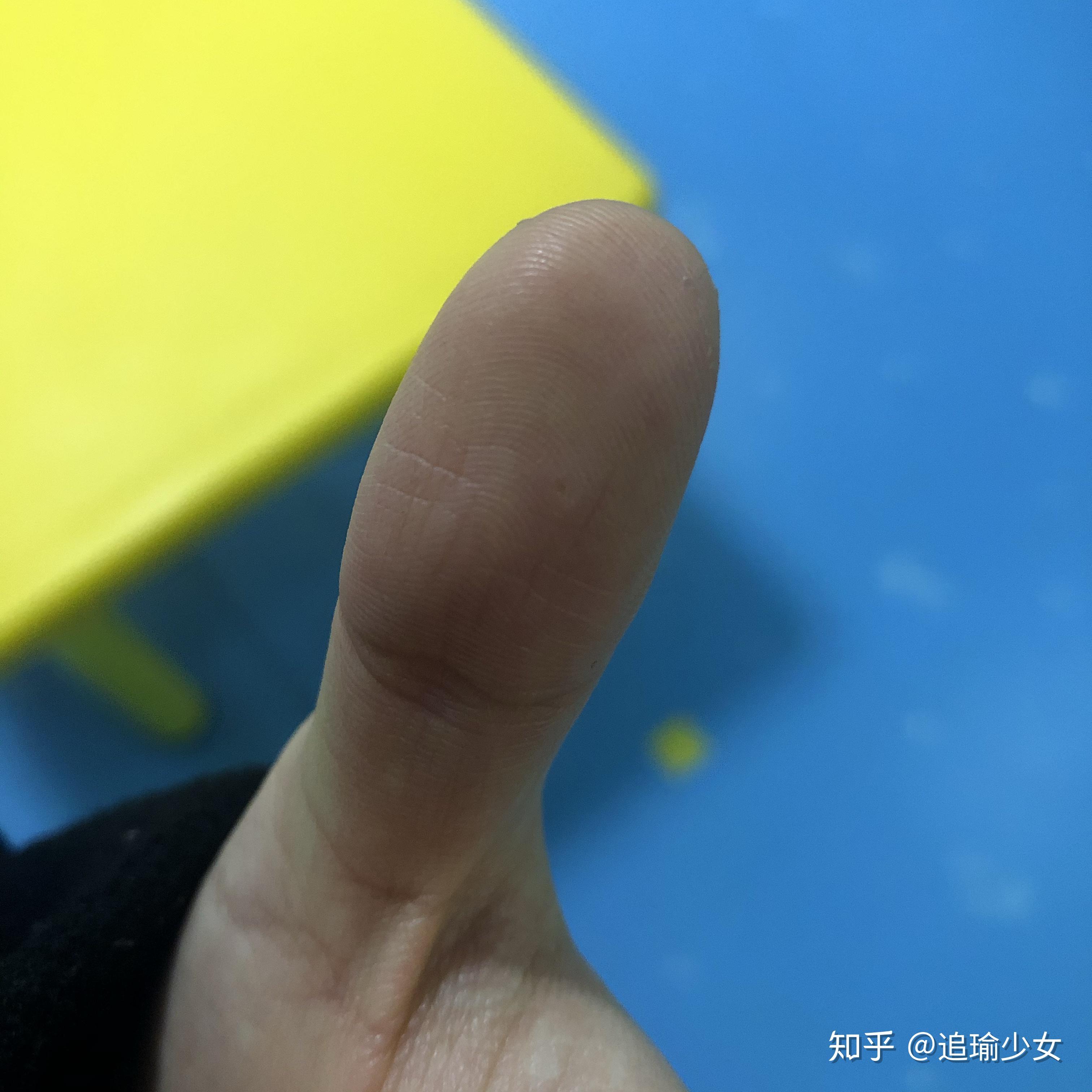 请各位懂一点的帮忙看一下是不是鸡眼!谢谢拜托了!