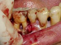 牙周炎还是牙龈炎?傻傻分不清楚!