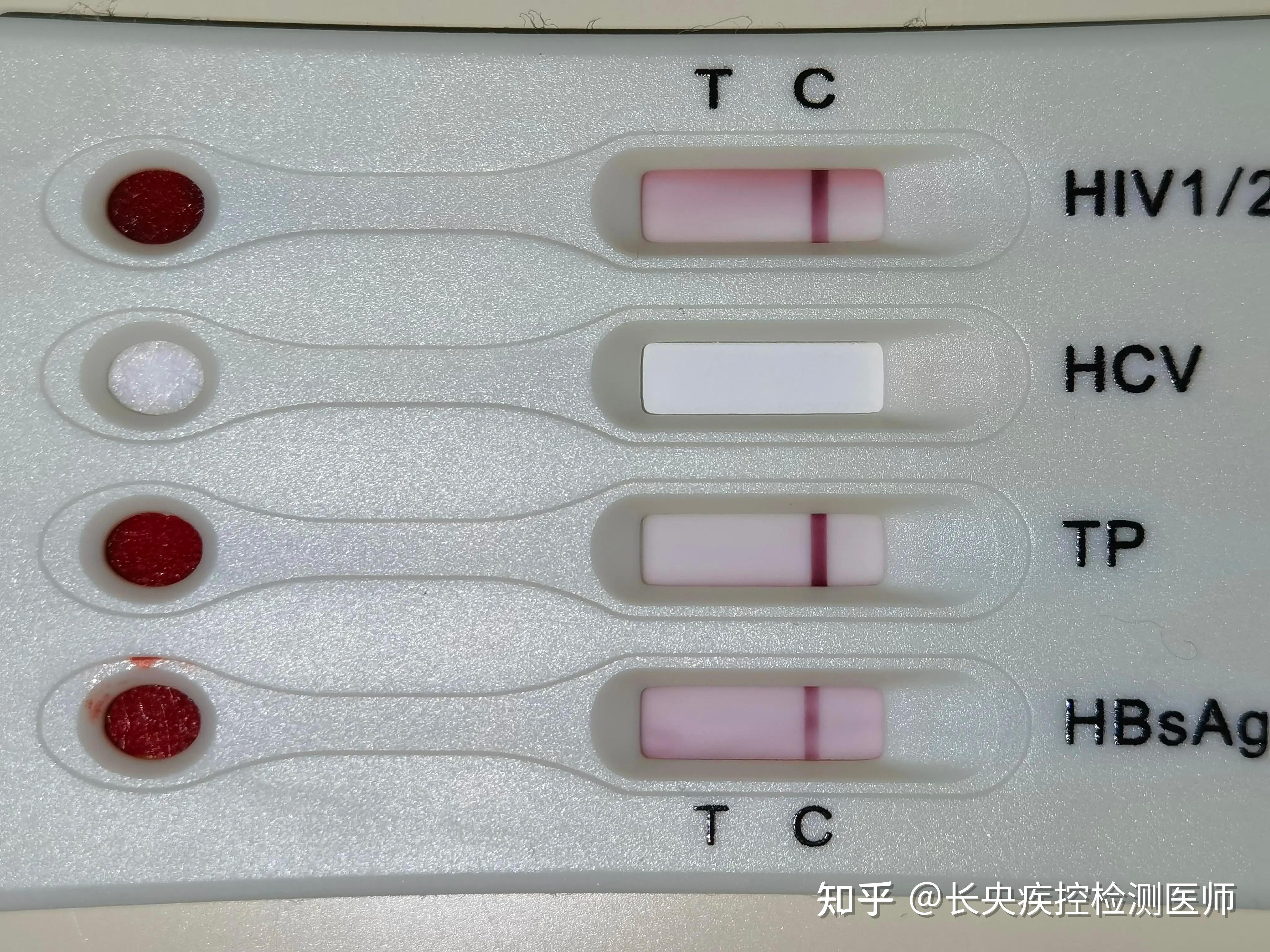 请问万孚四合一试纸测hiv准吗