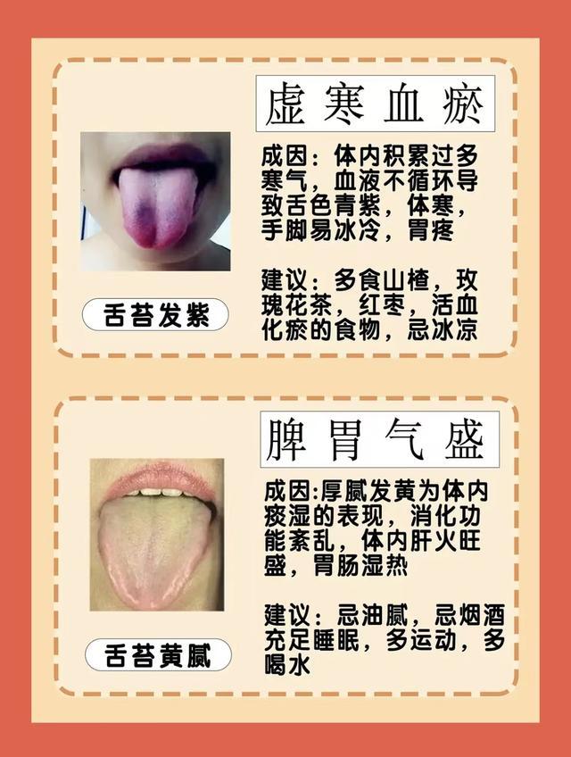 6种常见舌象,对照一下自己 - 知乎