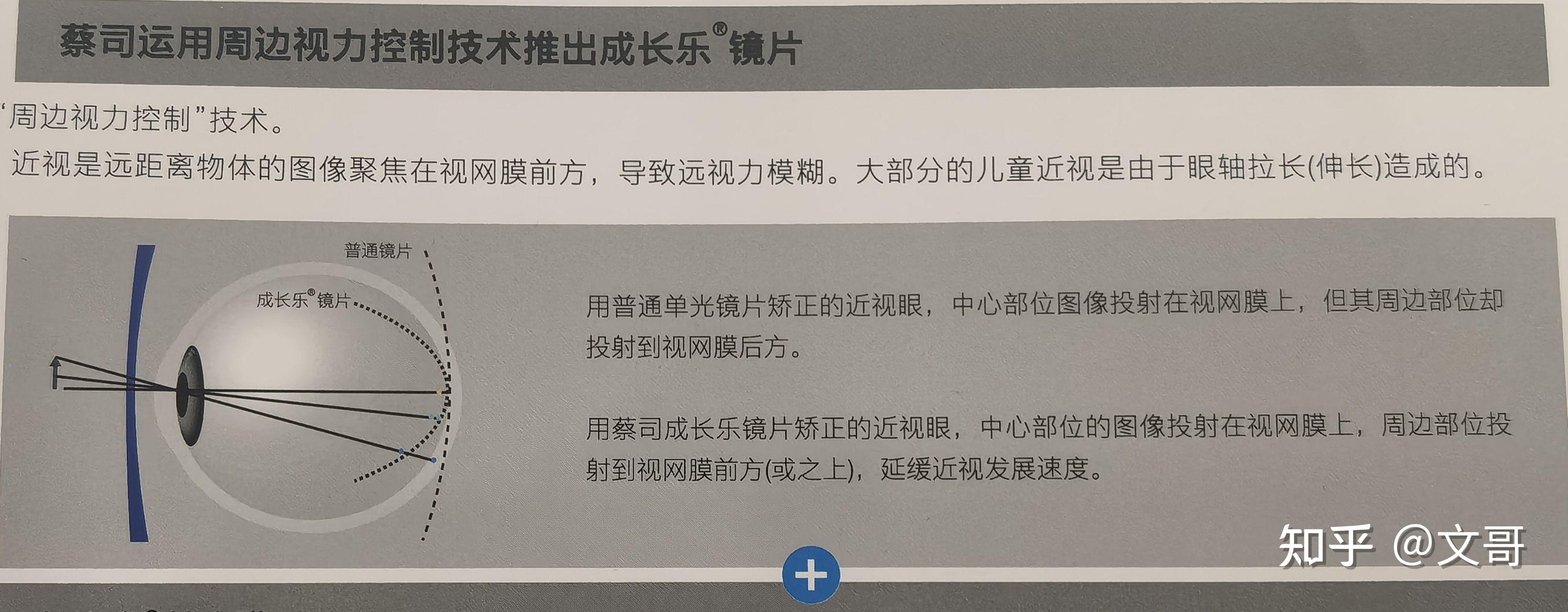 成长乐镜片原理图片