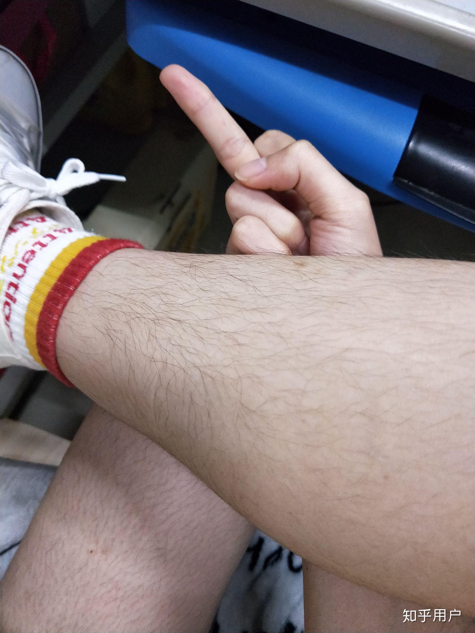 腿毛长的女生一定要脱毛吗?