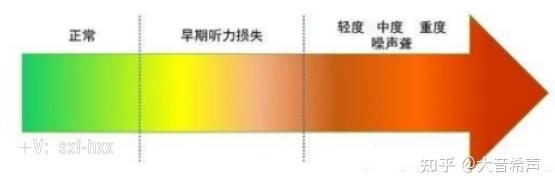 人耳是如何感知声音的以及噪声性耳聋 - 知乎