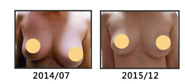 大小胸问题详解~