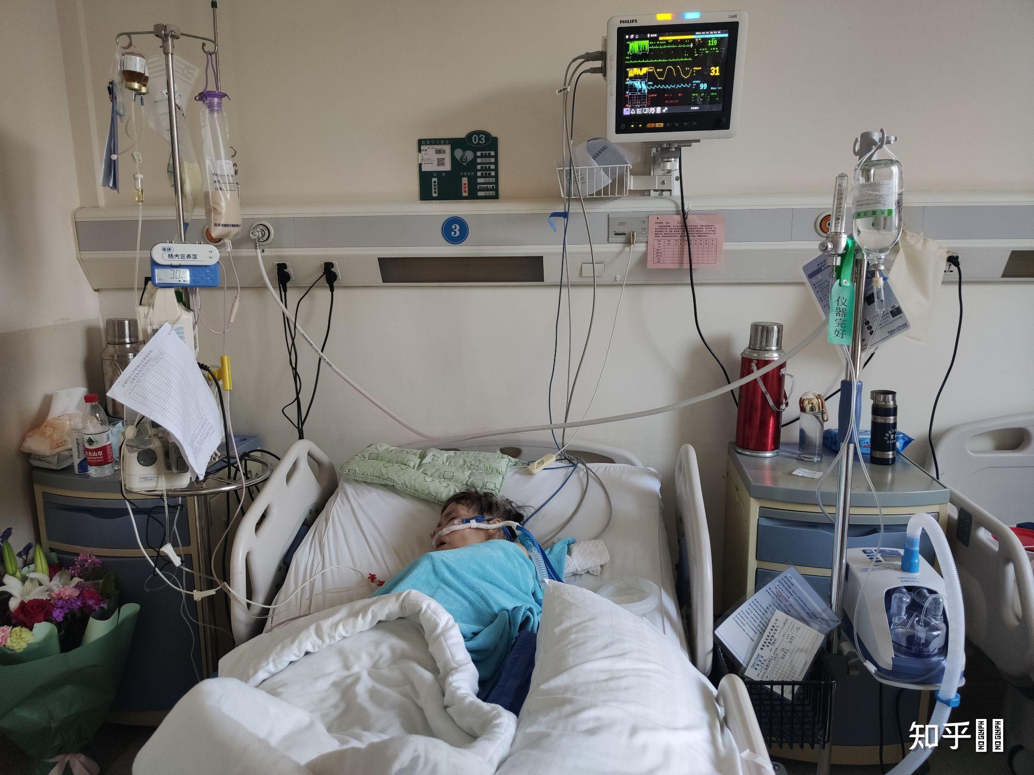 你知道的胰腺癌患者都活了多久? - 知乎