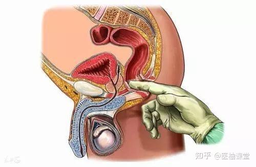 直肠指诊多被用于辅助诊断痔,肛裂,肛瘘,直肠肿瘤,肛乳头瘤等疾病.