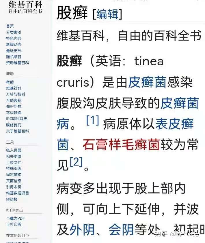 股癬它老人家,只是單純的皮膚病但恰好又傳染性極高雖然它生於私處,長