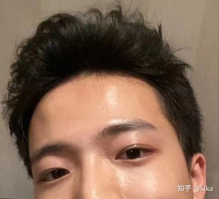 男生如何让发量变多变帅