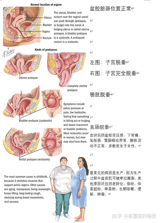 阴壁膨出有什么危害图片