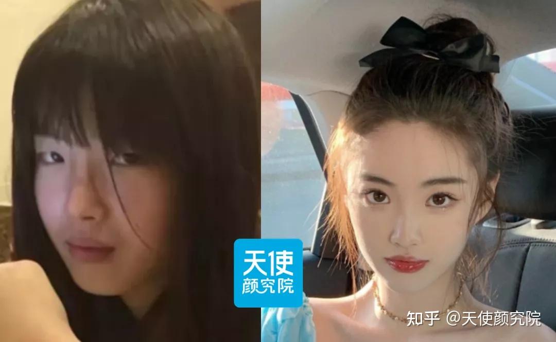人造孙一宁半藏森林她用脑子整出了全网唯一的贵气千金脸