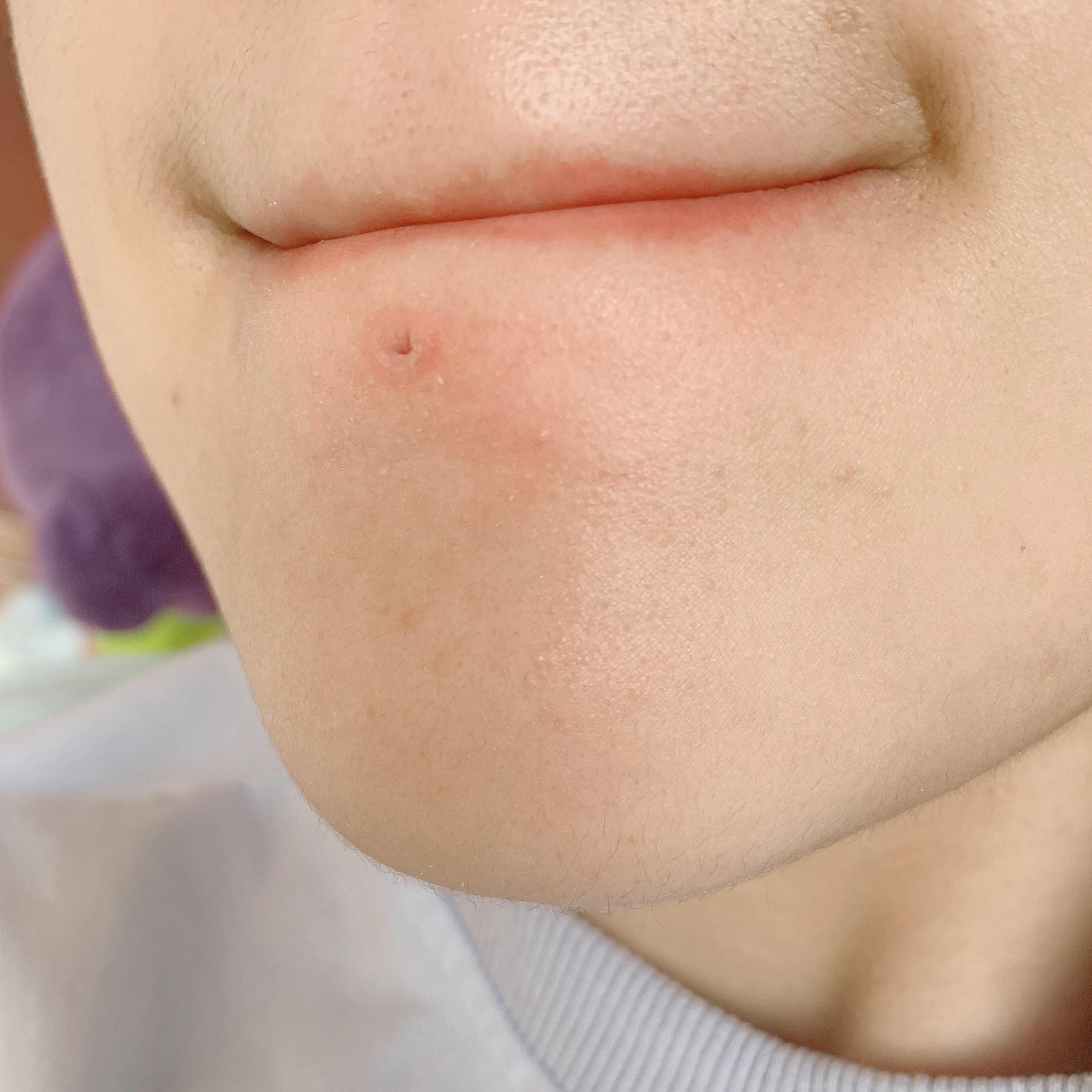 我想看看唇钉摘下后是什么样子的