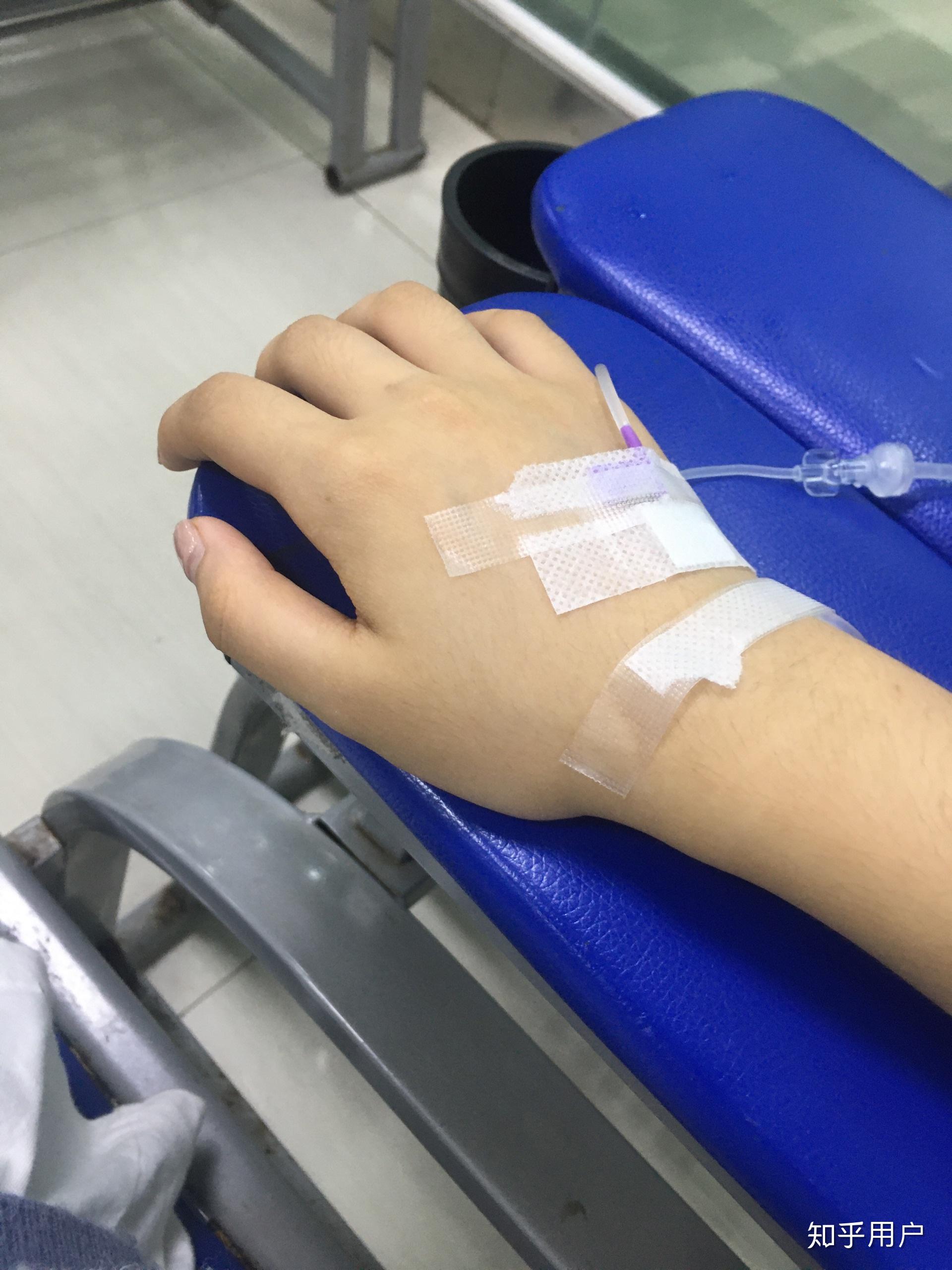 重度抑郁症患者真的可以掩饰自己到与正常人无异吗