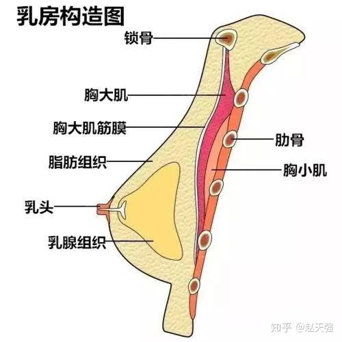 怎么选择合适的胸假体 v2-59ab0b56b5e0c91f8321e95dc3b661e4_r.jpg