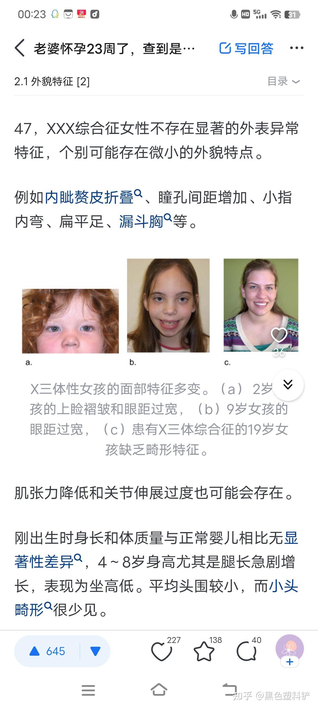 老婆怀孕23周了,查到是超雌宝宝,47xxx,想留,有相似经历的父母们能给