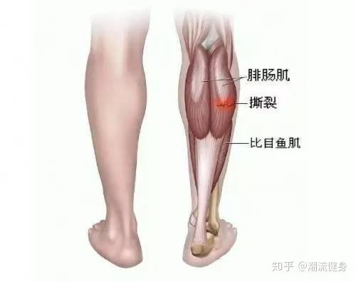 ふくらはぎの筋肉を失う方法は 美少女を見よ すべて