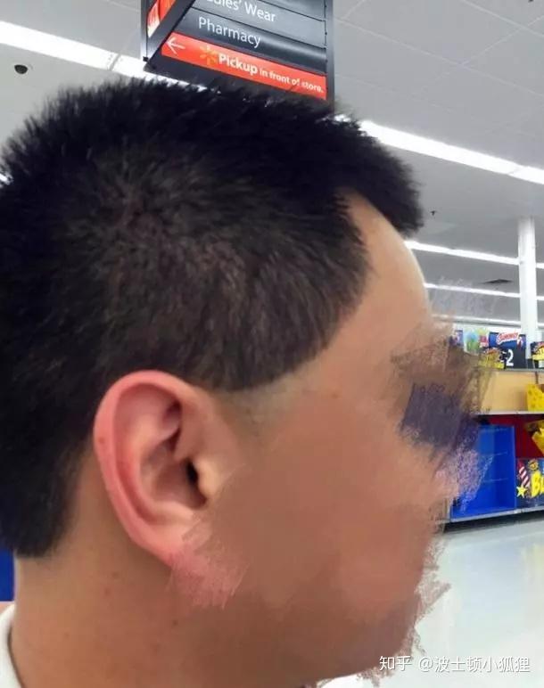 结果理发师推子一撸,直接从鬓角处一路推到后脑勺,理了一个西瓜头出来