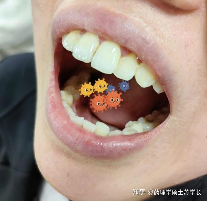 v2-59ea9539ad78e53e02eabf3e6e7fc624_r.jpg