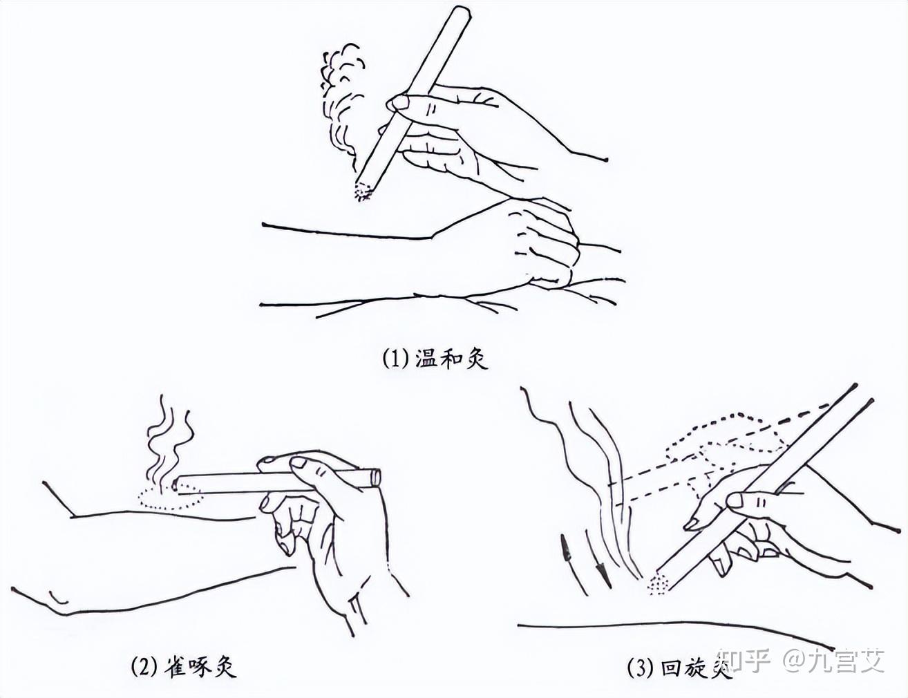 怎样艾灸正确方法图片图片