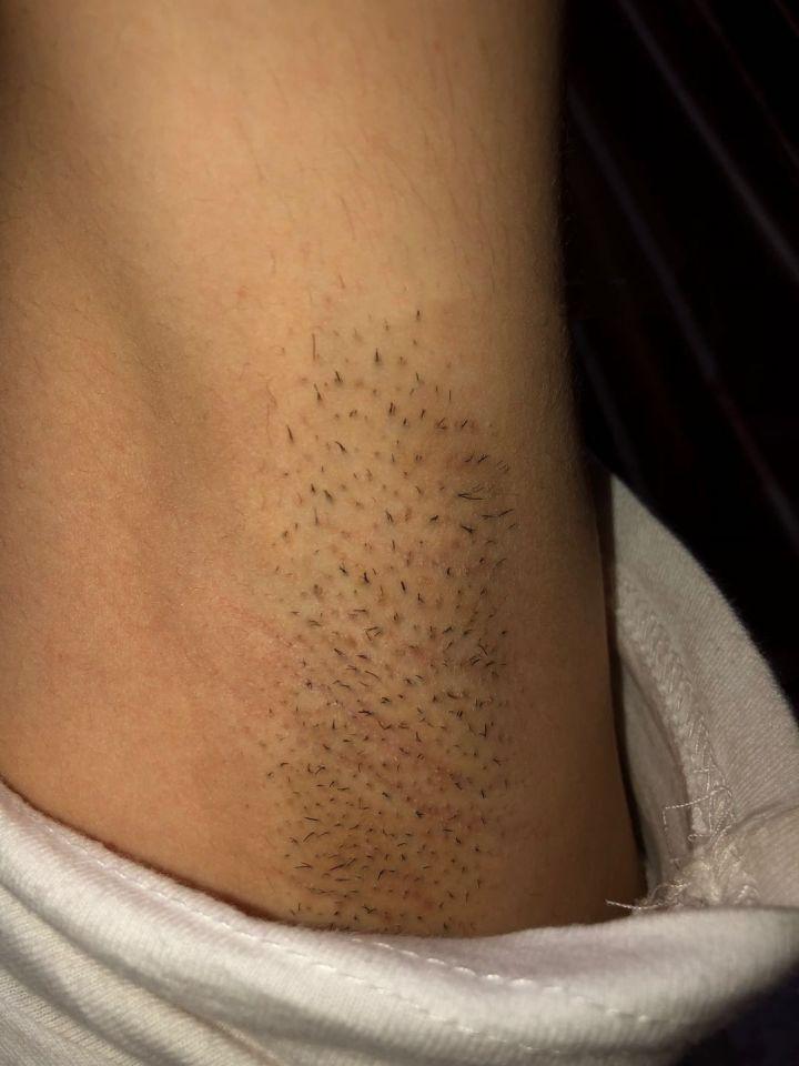 有什么效果好的脱毛膏对身体没有危害