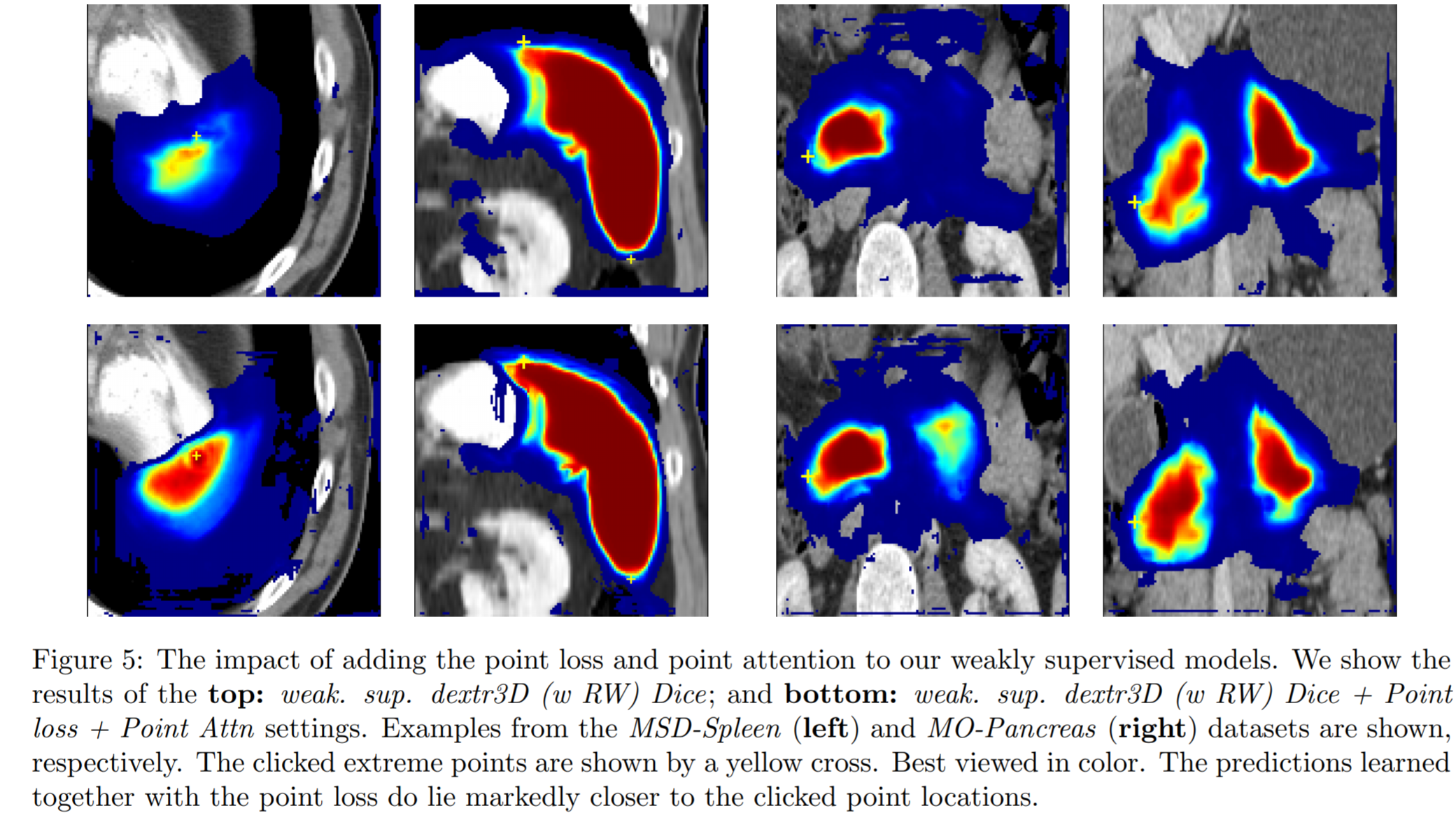 使用过完备表示实现生物医学图像的准确分割作者:jeya