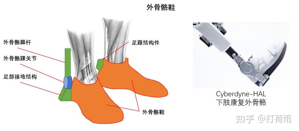 外骨骼绑缚——不可或缺的人机物理接口 - 知乎