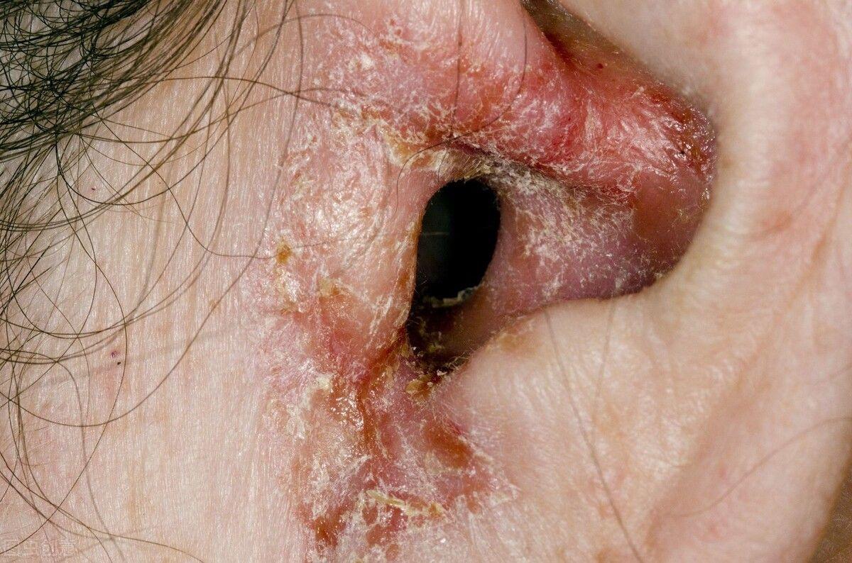 耳朵里面如果经常发痒,或是4种病的表现,提醒:大家最好上点心