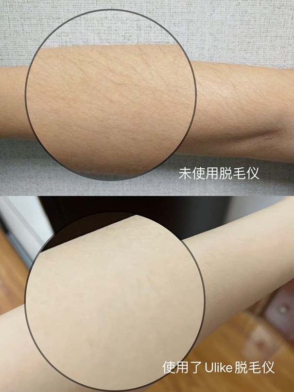 摸上去已经没有明显毛茬感了,手臂很光滑,比没刮毛之前白了一丢丢哦!