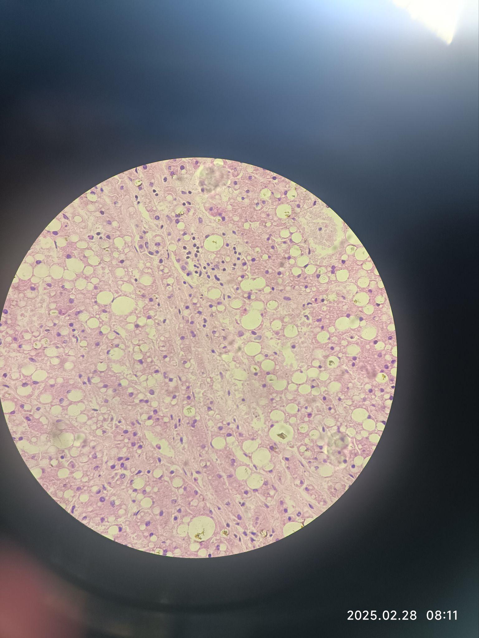 病理学实验切片