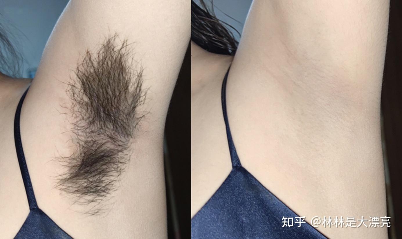 一直用脱毛膏脱毛行吗? - 知乎