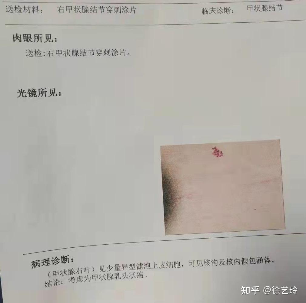 河南省人民医院病历图片