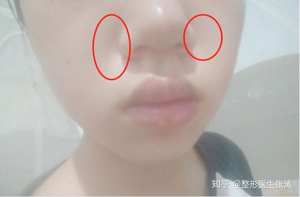 v2-5aa17a1b5adbfa32e267d35fc4aadb4c_r.jpg