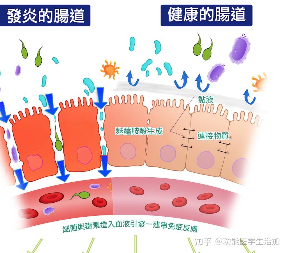 過敏性疾病是一種免疫變態反應,隨著感染性疾病的控制和工業化程度的