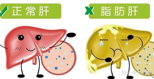 关于高血脂和脂肪肝