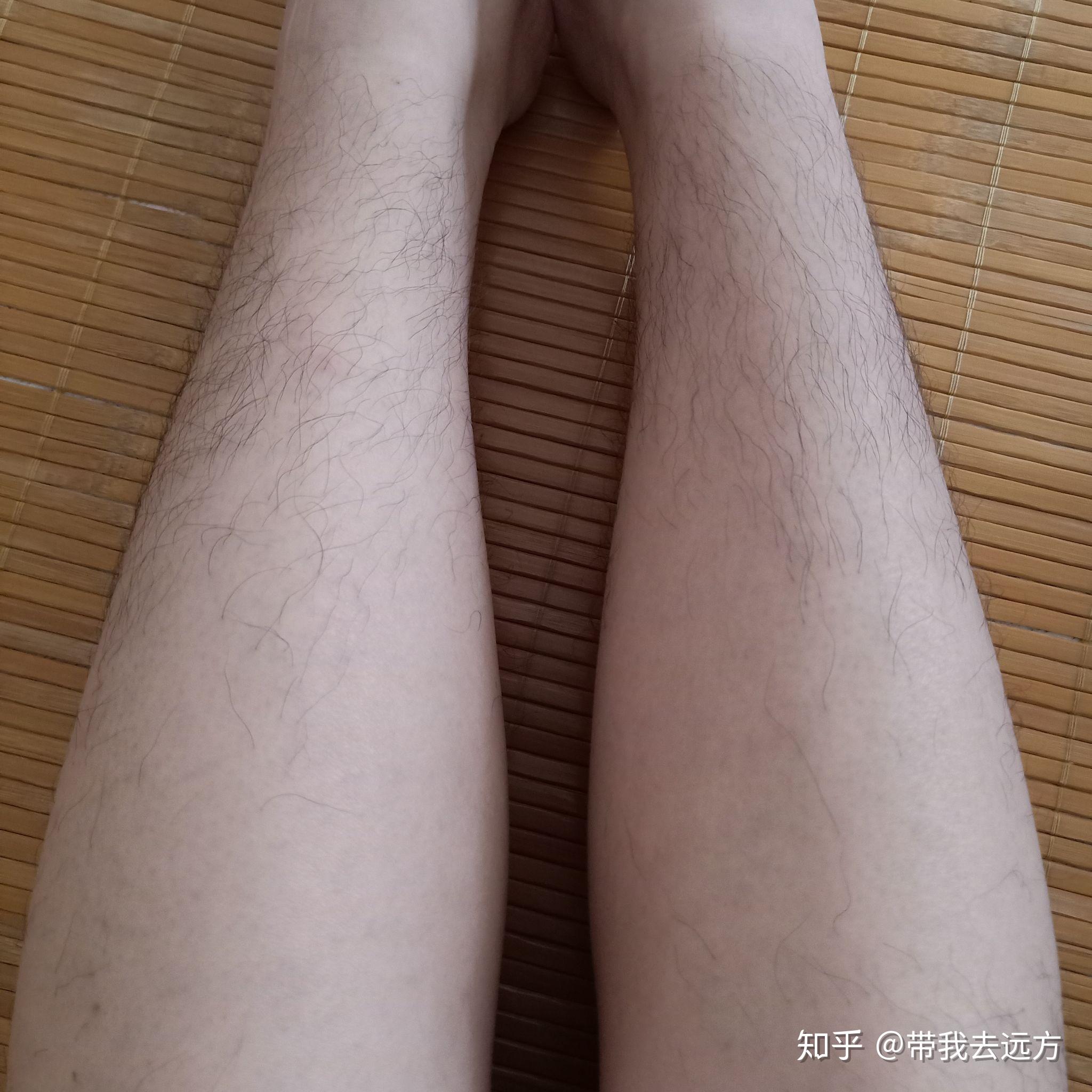 女生腿毛长正常吗?